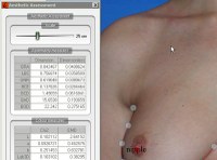 Projeto  3D BCT - Modelos 3D para Avaliação e previsão do resultado estético em intervenções por cancro da mama 